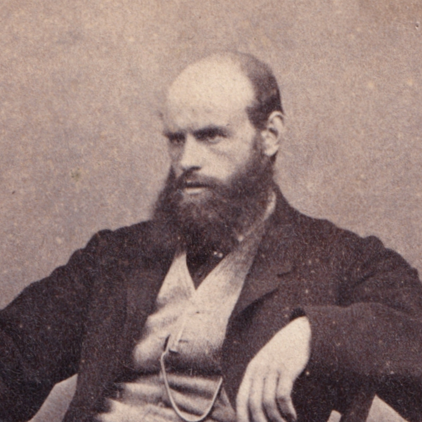 CDV: CDV: W.F. Ferguson Card, Holmfirth, Yorkshire. Seated Man with Beard.: catalogue image 2